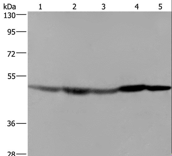 FH / Fumarase / MCL Antibody - Western blot analysis of HeLa cell, mouse liver, brain and heart tissue, RAW264.7 cell, using FH Polyclonal Antibody at dilution of 1:600.