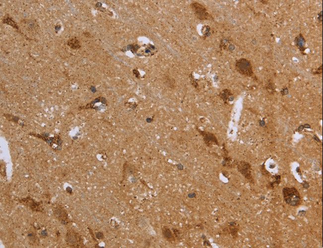 FH / Fumarase / MCL Antibody - Immunohistochemistry of paraffin-embedded Human brain using FH Polyclonal Antibody at dilution of 1:30.