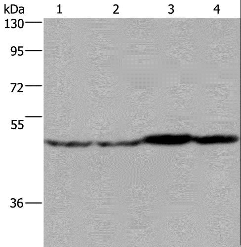 FH / Fumarase / MCL Antibody - Western blot analysis of Mouse liver, brain and heart tissue, RAW264.7 cell, using FH Polyclonal Antibody at dilution of 1:850.