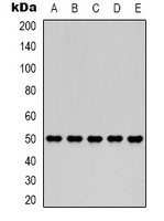 FH / Fumarase / MCL Antibody - Western blot analysis of Fumarase expression in 293T (A); HepG2 (B); HeLa (C); mouse brain (D); rat brain (E) whole cell lysates.