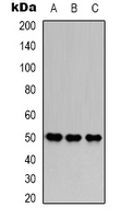 FH / Fumarase / MCL Antibody - Western blot analysis of Fumarase expression in HeLa (A); HepG2 (B); mouse brain (C) whole cell lysates.