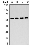 FH / Fumarase / MCL Antibody - Western blot analysis of FH expression in HepG2 (A); THP1 (B); SW480 (C); HeLa (D) whole cell lysates.