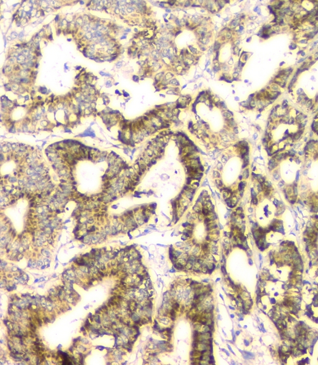 FH / Fumarase / MCL Antibody - IHC analysis of FH using anti-FH antibody. FH was detected in paraffin-embedded section of rat liver tissues. Heat mediated antigen retrieval was performed in citrate buffer (pH6, epitope retrieval solution) for 20 mins. The tissue section was blocked with 10% goat serum. The tissue section was then incubated with 1µg/ml mouse anti-FH Antibody overnight at 4°C. Biotinylated goat anti-mouse IgG was used as secondary antibody and incubated for 30 minutes at 37°C. The tissue section was developed using Strepavidin-Biotin-Complex (SABC) with DAB as the chromogen.