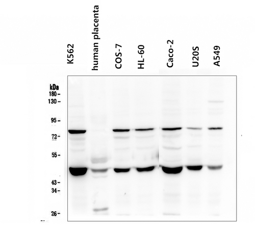 FH / Fumarase / MCL Antibody - Western blot analysis of FH using anti-FH antibody. Electrophoresis was performed on a 5-20% SDS-PAGE gel at 70V (Stacking gel) / 90V (Resolving gel) for 2-3 hours. The sample well of each lane was loaded with 50ug of sample under reducing conditions. After Electrophoresis, proteins were transferred to a Nitrocellulose membrane at 150mA for 50-90 minutes. Blocked the membrane with 5% Non-fat Milk/ TBS for 1.5 hour at RT. The membrane was incubated with mouse anti-FH antigen affinity purified monoclonal antibody at 0.5 µg/mL overnight at 4°C, then washed with TBS-0.1% Tween 3 times with 5 minutes each and probed with a goat anti-mouse IgG-HRP secondary antibody at a dilution of 1:10000 for 1.5 hour at RT. The signal is developed using an Enhanced Chemiluminescent detection (ECL) kit with Tanon 5200 system.