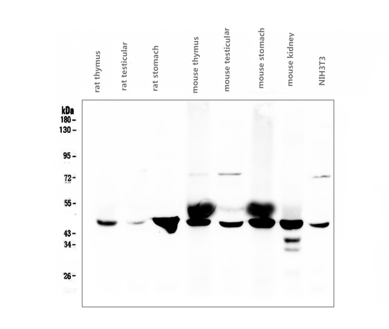 FH / Fumarase / MCL Antibody - Western blot analysis of FH using anti-FH antibody. Electrophoresis was performed on a 5-20% SDS-PAGE gel at 70V (Stacking gel) / 90V (Resolving gel) for 2-3 hours. The sample well of each lane was loaded with 50ug of sample under reducing conditions. After Electrophoresis, proteins were transferred to a Nitrocellulose membrane at 150mA for 50-90 minutes. Blocked the membrane with 5% Non-fat Milk/ TBS for 1.5 hour at RT. The membrane was incubated with mouse anti-FH antigen affinity purified monoclonal antibody at 0.5 µg/mL overnight at 4°C, then washed with TBS-0.1% Tween 3 times with 5 minutes each and probed with a goat anti-mouse IgG-HRP secondary antibody at a dilution of 1:10000 for 1.5 hour at RT. The signal is developed using an Enhanced Chemiluminescent detection (ECL) kit with Tanon 5200 system.