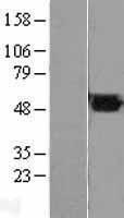 FH / Fumarase / MCL Protein - Western validation with an anti-DDK antibody * L: Control HEK293 lysate R: Over-expression lysate