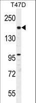 FHAD1 Antibody - FHAD1 Antibody western blot of T47D cell line lysates (35 ug/lane). The FHAD1 antibody detected the FHAD1 protein (arrow).