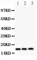 FHIT Antibody - FHIT antibody Western blot. All lanes: Anti FHIT at 0.5 ug/ml. Lane 1: HT1080 Whole Cell Lysate at 40 ug. Lane 2: SW620 Whole Cell Lysate at 40 ug. Lane 3: Jurkat Whole Cell Lysate at 40 ug. Predicted band size: 17 kD. Observed band size: 17 kD.