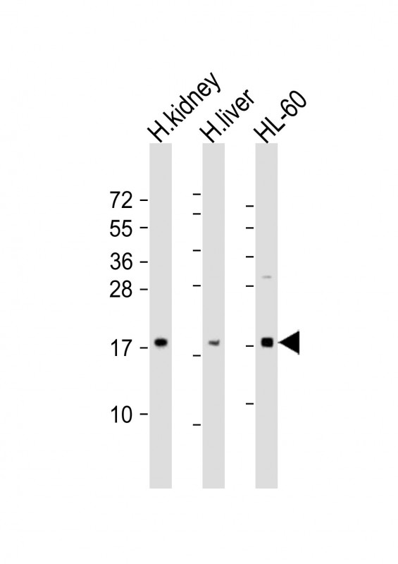 FHIT Antibody - All lanes: Anti-FHIT Antibody (N-Term) at 1:2000 dilution. Lane 1: human kidney lysate. Lane 2: human liver lysate. Lane 3: HL-60 whole cell lysate Lysates/proteins at 20 ug per lane. Secondary Goat Anti-Rabbit IgG, (H+L), Peroxidase conjugated at 1:10000 dilution. Predicted band size: 17 kDa. Blocking/Dilution buffer: 5% NFDM/TBST.