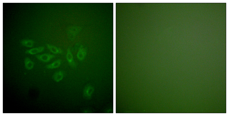 FHIT Antibody - Immunofluorescence analysis of A549 cells, using FHIT Antibody. The picture on the right is blocked with the synthesized peptide.
