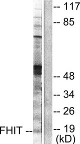 FHIT Antibody - Western blot analysis of lysates from A549 cells, using FHIT Antibody. The lane on the right is blocked with the synthesized peptide.
