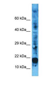 FHIT Antibody - Western blot of FHIT Antibody with human MCF7 Whole Cell lysate.  This image was taken for the unconjugated form of this product. Other forms have not been tested.