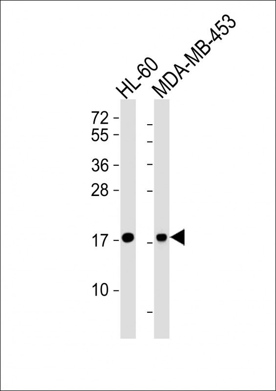 FHIT Antibody - All lanes : Anti-FHIT Antibody at 1:4000 dilution Lane 1: HL-60 whole cell lysates Lane 2: MDA-MB-453 whole cell lysates Lysates/proteins at 20 ug per lane. Secondary Goat Anti-Rabbit IgG, (H+L), Peroxidase conjugated at 1/10000 dilution Predicted band size : 17 kDa Blocking/Dilution buffer: 5% NFDM/TBST.