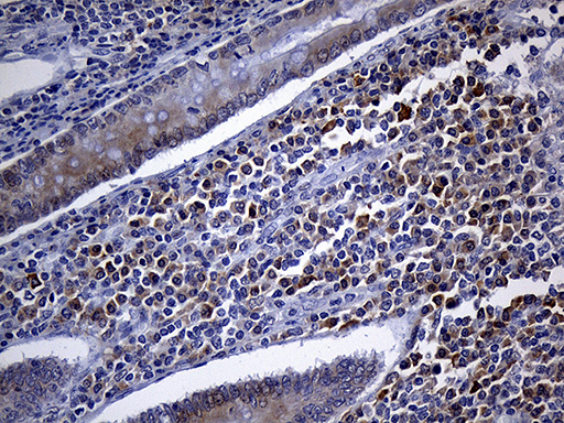 FHIT Antibody - Immunohistochemical staining of paraffin-embedded Human appendix tissue within the normal limits using anti-FHIT mouse monoclonal antibody. (Heat-induced epitope retrieval by 1mM EDTA in 10mM Tris buffer. (pH8.5) at 120°C for 3 min. (1:250)