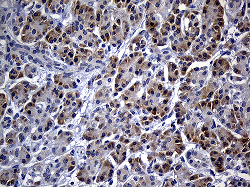 FHIT Antibody - Immunohistochemical staining of paraffin-embedded Human pancreas tissue within the normal limits using anti-FHIT mouse monoclonal antibody. (Heat-induced epitope retrieval by 1mM EDTA in 10mM Tris buffer. (pH8.5) at 120°C for 3 min. (1:250)