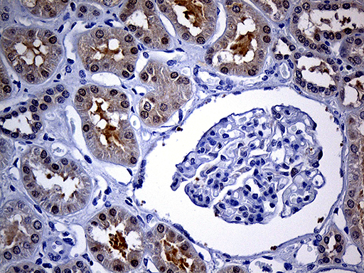 FHIT Antibody - Immunohistochemical staining of paraffin-embedded Human Kidney tissue within the normal limits using anti-FHIT mouse monoclonal antibody. (Heat-induced epitope retrieval by 1mM EDTA in 10mM Tris buffer. (pH8.5) at 120°C for 3 min. (1:250)