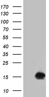 FHIT Antibody - HEK293T cells were transfected with the pCMV6-ENTRY control. (Left lane) or pCMV6-ENTRY FHIT. (Right lane) cDNA for 48 hrs and lysed