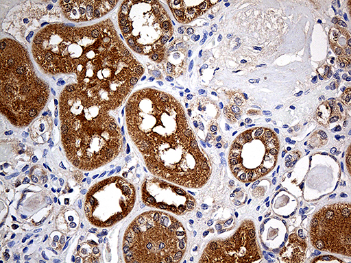 FHIT Antibody - Immunohistochemical staining of paraffin-embedded Human Kidney tissue within the normal limits using anti-FHIT mouse monoclonal antibody. (Heat-induced epitope retrieval by 1mM EDTA in 10mM Tris buffer. (pH8.5) at 120°C for 3 min. (1:500)