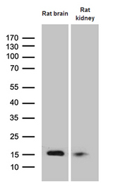 FHIT Antibody - Western blot analysis of extracts. (35ug) from 2 tissue lysates by using anti-FHIT monoclonal antibody. (1:500)
