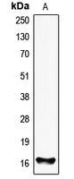 FHIT Antibody - Western blot analysis of FHIT expression in HEK293T (A) whole cell lysates.