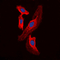 FHIT Antibody - Immunofluorescent analysis of FHIT staining in HEK293T cells. Formalin-fixed cells were permeabilized with 0.1% Triton X-100 in TBS for 5-10 minutes and blocked with 3% BSA-PBS for 30 minutes at room temperature. Cells were probed with the primary antibody in 3% BSA-PBS and incubated overnight at 4 C in a humidified chamber. Cells were washed with PBST and incubated with a DyLight 594-conjugated secondary antibody (red) in PBS at room temperature in the dark. DAPI was used to stain the cell nuclei (blue).