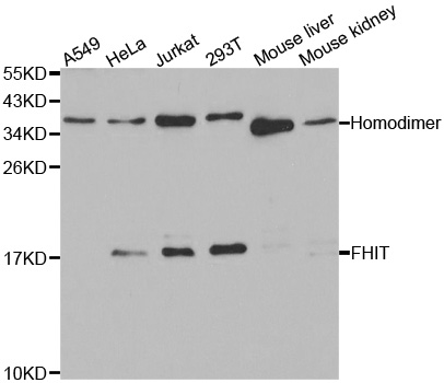 FHIT Antibody - Western blot analysis of extracts of various cell lines, using FHIT antibody at 1:1000 dilution. The secondary antibody used was an HRP Goat Anti-Rabbit IgG (H+L) at 1:10000 dilution. Lysates were loaded 25ug per lane and 3% nonfat dry milk in TBST was used for blocking.