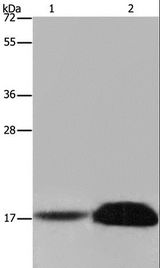 FHIT Antibody - Western blot analysis of Mouse kidney and human kidney tissue, using FHIT Polyclonal Antibody at dilution of 1:600.