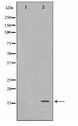 FHIT Antibody - Western blot of A549 cell lysate using FHIT Antibody