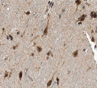 FHIT Antibody - 1:100 staining human brain tissue by IHC-P. The tissue was formaldehyde fixed and a heat mediated antigen retrieval step in citrate buffer was performed. The tissue was then blocked and incubated with the antibody for 1.5 hours at 22°C. An HRP conjugated goat anti-rabbit antibody was used as the secondary.