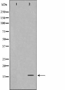 FHIT Antibody - Western blot analysis on A549 cell lysates using FHIT antibody. The lane on the left is treated with the antigen-specific peptide.