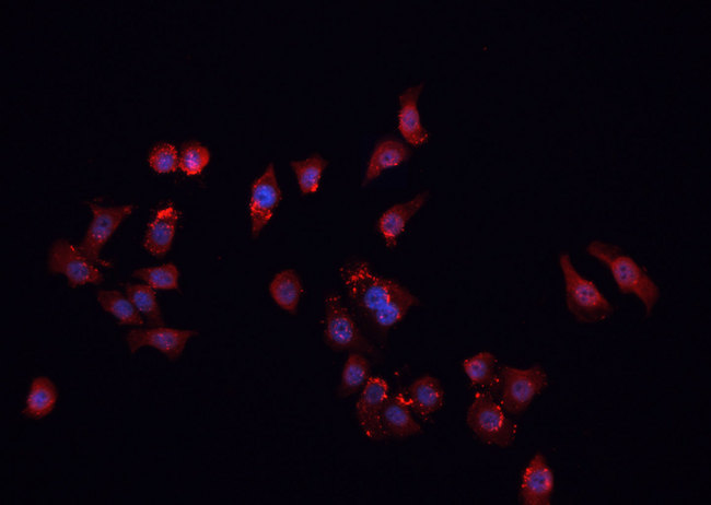 FHIT Antibody - Staining MCF-7 cells by IF/ICC. The samples were fixed with PFA and permeabilized in 0.1% Triton X-100, then blocked in 10% serum for 45 min at 25°C. The primary antibody was diluted at 1:200 and incubated with the sample for 1 hour at 37°C. An Alexa Fluor 594 conjugated goat anti-rabbit IgG (H+L) antibody, diluted at 1/600, was used as secondary antibody.