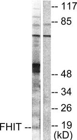 FHIT Antibody - Western blot analysis of extracts from A549 cells, using FHIT antibody.