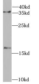FHIT Antibody - HeLa cells were subjected to SDS PAGE followed by western blot with anti-FHIT antibody at dilution of 1:1000