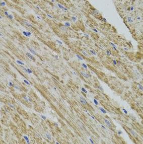 FHIT Antibody - Immunohistochemistry of paraffin-embedded mouse heart tissue slide using FHIT antibody at dilution of 1:200