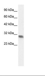 FHL2 Antibody - Fetal Heart Lysate.  This image was taken for the unconjugated form of this product. Other forms have not been tested.