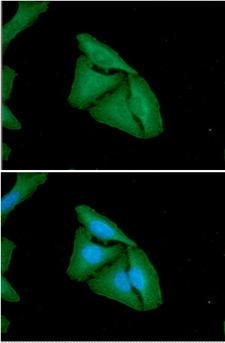 FHL2 Antibody - ICC/IF analysis of FHL2 in HeLa cells. The cell was stained with FHL2 antibody (1:100).The secondary antibody (green) was used Alexa Fluor 488. DAPI was stained the cell nucleus (blue).