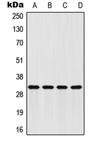 FHL2 Antibody - Western blot analysis of FHL2 expression in HeLa (A); HepG2 (B); mouse brain (C); H9C2 (D) whole cell lysates.