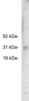 FHL2 Antibody - Western blot of FHL2, rabbit polyclonal at 0.5 ug/ml on HeLa cell extract (10 ug/lane). Blots were developed with goat anti-rabbit Ig (1:75k) and Pierce Supersignal West Femto system.