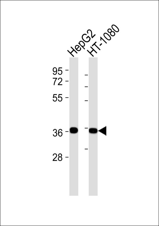 FHL2 Antibody - All lanes : Anti-FHL2 Antibody at 1:1000 dilution Lane 1: HepG2 whole cell lysates Lane 2: HT-1080 whole cell lysates Lysates/proteins at 20 ug per lane. Secondary Goat Anti-Rabbit IgG, (H+L),Peroxidase conjugated at 1/10000 dilution Predicted band size : 32 kDa Blocking/Dilution buffer: 5% NFDM/TBST.