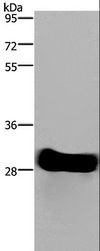 FHL2 Antibody - Western blot analysis of Mouse heart tissue, using FHL2 Polyclonal Antibody at dilution of 1:1900.