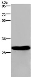 FHL2 Antibody - Western blot analysis of Mouse heart tissue, using FHL2 Polyclonal Antibody at dilution of 1:2400.