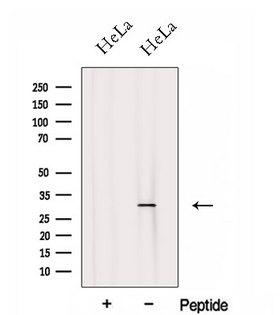FHL2 Antibody - Western blot analysis of extracts of HeLa cells using FHL2 antibody. The lane on the left was treated with blocking peptide.