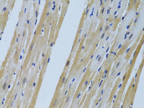 FHL2 Antibody - Immunohistochemistry of paraffin-embedded Mouse heart using FHL2 Polyclonal Antibody at dilution of 1:100 (40x lens).