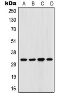 FHL3 Antibody - Western blot analysis of FHL3 expression in K562 (A); HeLa (B); Raw264.7 (C); PC12 (D) whole cell lysates.