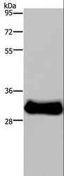 FHL3 Antibody - Western blot analysis of Mouse skeletal muscle tissue, using FHL3 Polyclonal Antibody at dilution of 1:1600.