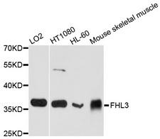 FHL3 Antibody - Western blot analysis of extract of various cells.