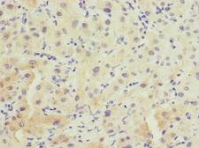 FHL3 Antibody - Immunohistochemistry of paraffin-embedded human liver tissue at dilution 1:100