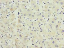 FHL3 Antibody - Immunohistochemistry of paraffin-embedded human liver tissue at dilution 1:100
