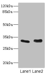 FHL3 Antibody - Western blot All Lanes: FHL3 antibody at 1.42ug/ml Lane 1: Human placenta tissue Lane 2: K562 whole cell lysate Secondary Goat polyclonal to rabbit IgG at 1/10000 dilution Predicted band size: 31 kDa Observed band size: 31 kDa