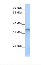 FHL5 Antibody - Placenta cell lysate. Antibody concentration: 0.5 ug/ml. Gel concentration: 12%.  This image was taken for the unconjugated form of this product. Other forms have not been tested.